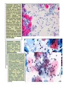 Cervicitis crónica   HISTOLOGIA